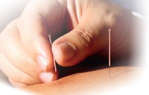 Agopuntura per disfunzione erettile